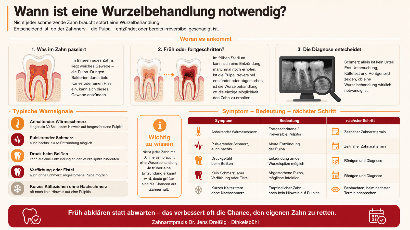 Eine Infografik erklärt, wann eine Wurzelbehandlung erforderlich ist. Sie zeigt Zahnquerschnitte, Warnzeichen, Symptome, Behandlungsentscheidungen und die nächsten Schritte bei Entzündungen oder Schmerzen. Farben: Rot, Beige, Braun.
