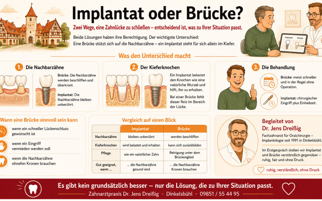 Implantat oder Brücke? Die wichtigsten Unterschiede verständlich erklärt